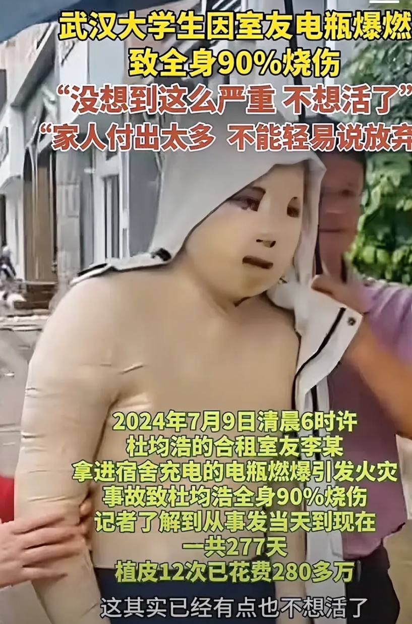 这个孩子命真苦！在被自己室友充电池烧伤后，对方赔偿一万摆烂了，后续的277天，植