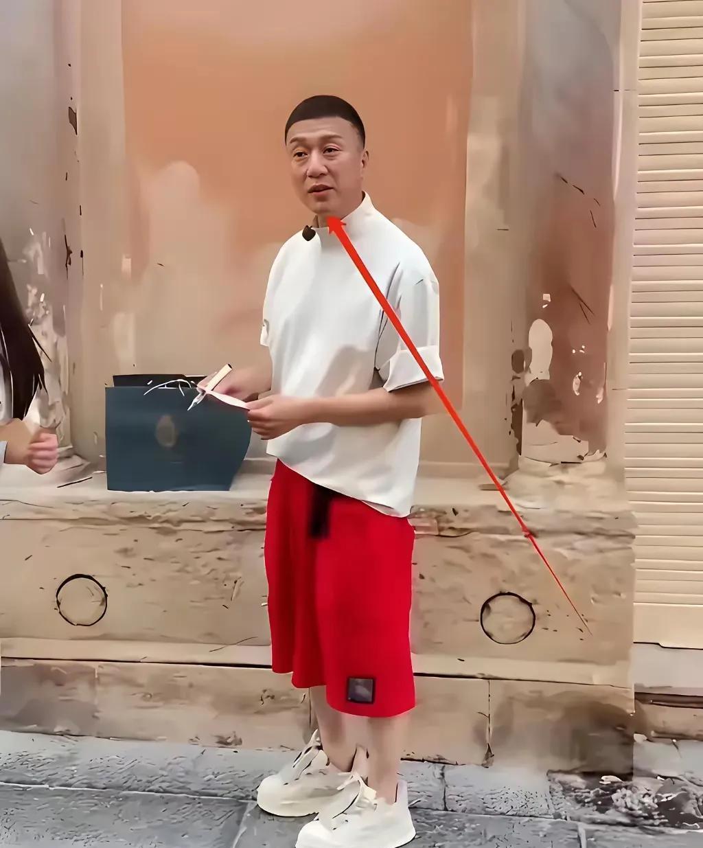 哦豁！孙红雷也去割双眼皮了，但总感觉怪怪的。
本来一双小眼睛是他的标签，这突然变