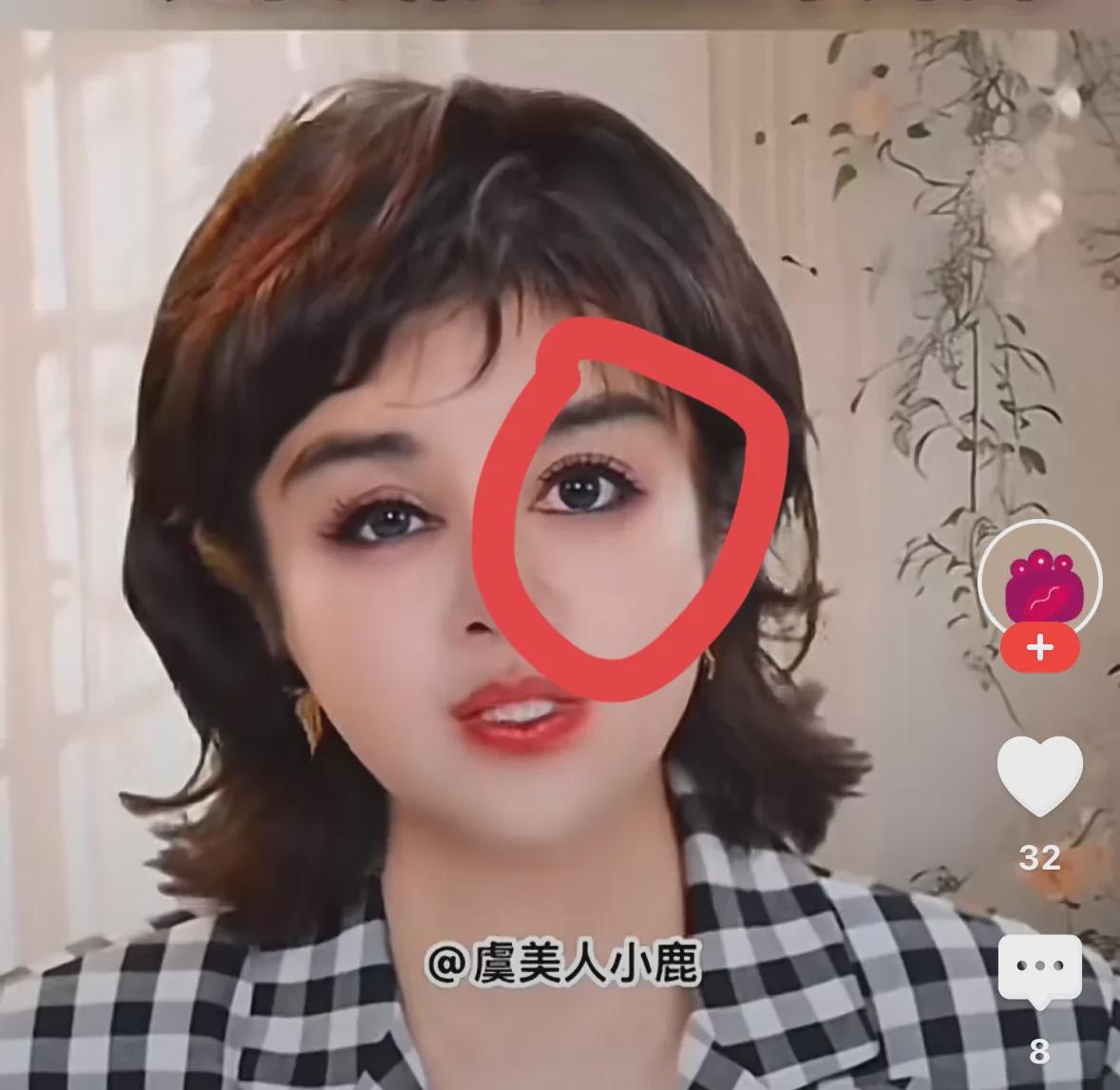 于文红整容失败眼睛一大一小还自我感觉良好，炒作前夫罗兰多当外交官，说要给大儿子生