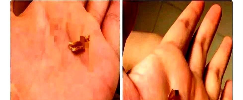 产后第十天躺床上喂奶时突然觉得左耳像蒙了层塑料布，连咽口水都带着闷闷的回声，强忍