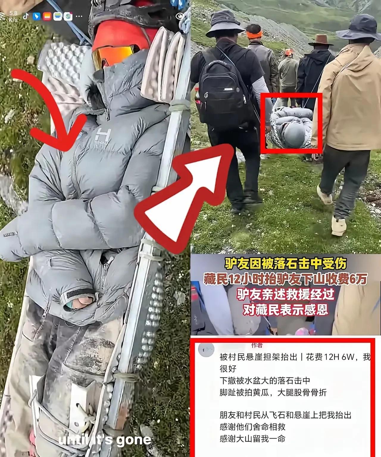 女子在4000米海拔被落石砸中，花费6万元被10名藏民轮流抬下及时就医后续！女子