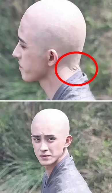敖瑞鹏，求求你了，照照镜子看看这个假光头，你看着不别扭吗？

明明长了一张帅脸，