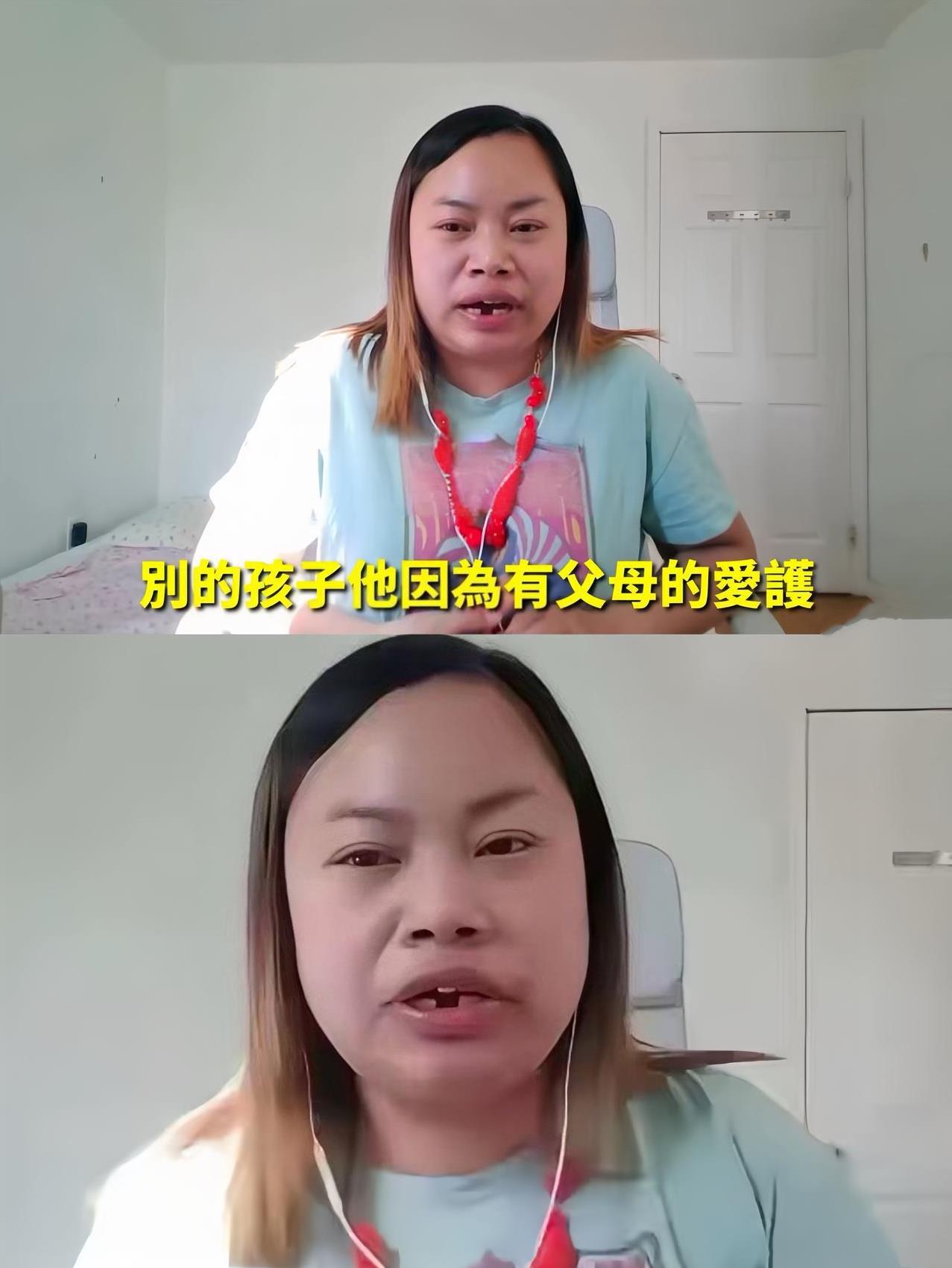专门去查了一下凤姐牙齿掉的原因
了解后真的太心疼了，
不是因为她不爱护牙齿，也不