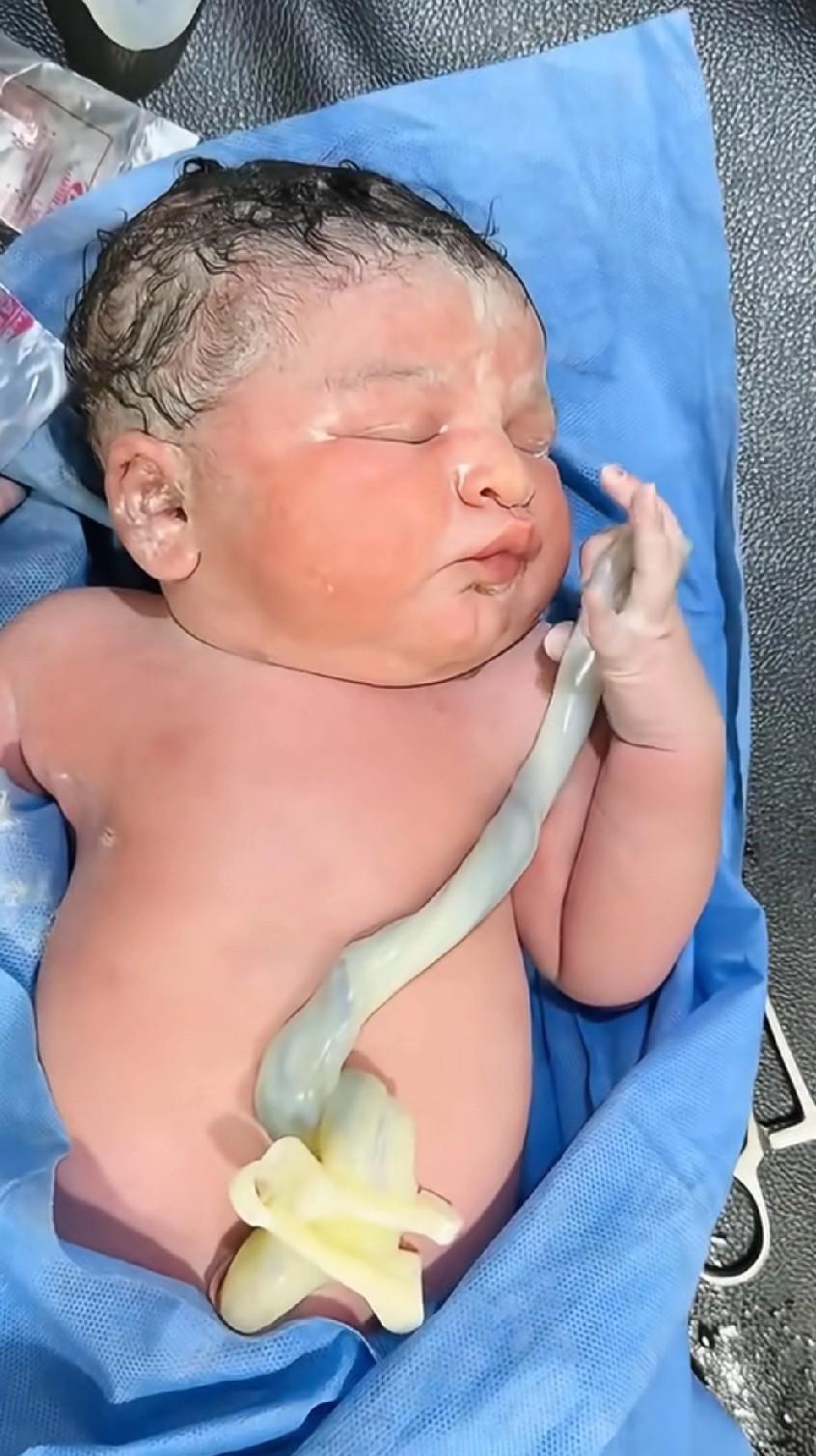 哇！头一回见到脐带实物，比想象中粗壮不少呢！虽说生了俩娃，还真没亲眼见过。这下算