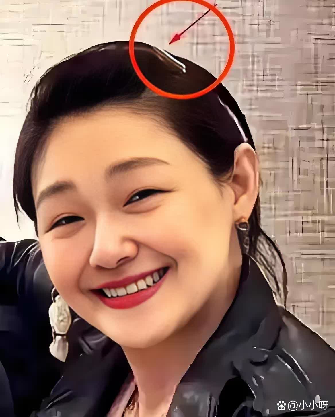 我们得珍惜身边人，因为生命真的很脆弱。人在快到生命尽头时，往往会有一些征兆，只是