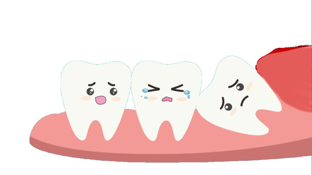 智齿发炎不用慌，这份自救指南请收好