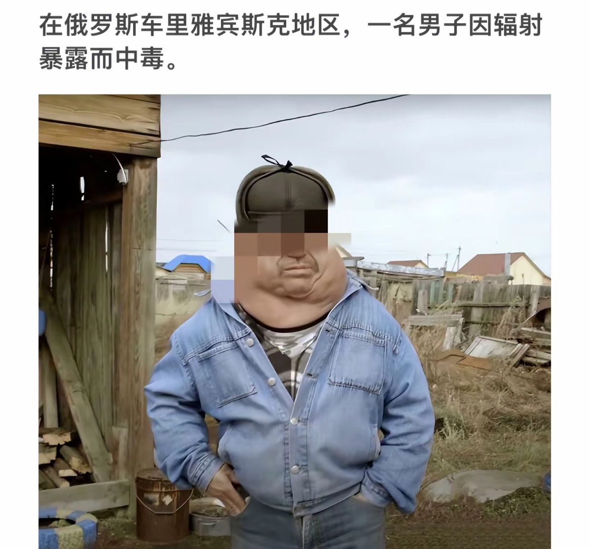 大毛变怪人，辐射在搞鬼











兄弟们，你们有没有想过，一个正常人
