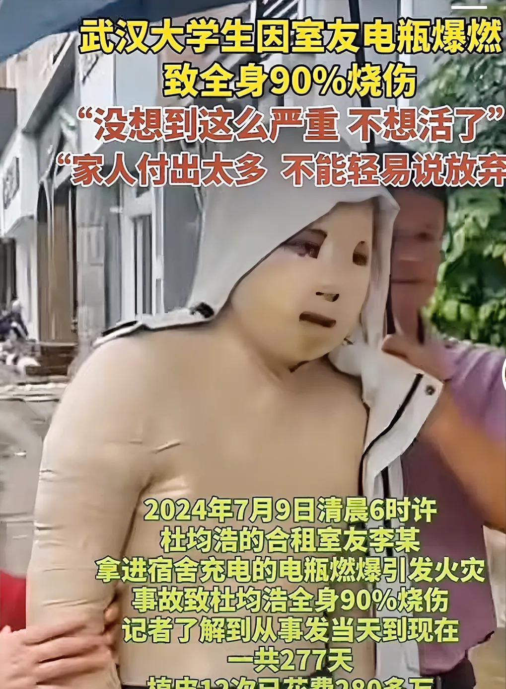 这个孩子命真苦！在被自己室友充电池烧伤后，对方赔偿一万摆烂了，后续的277天，植