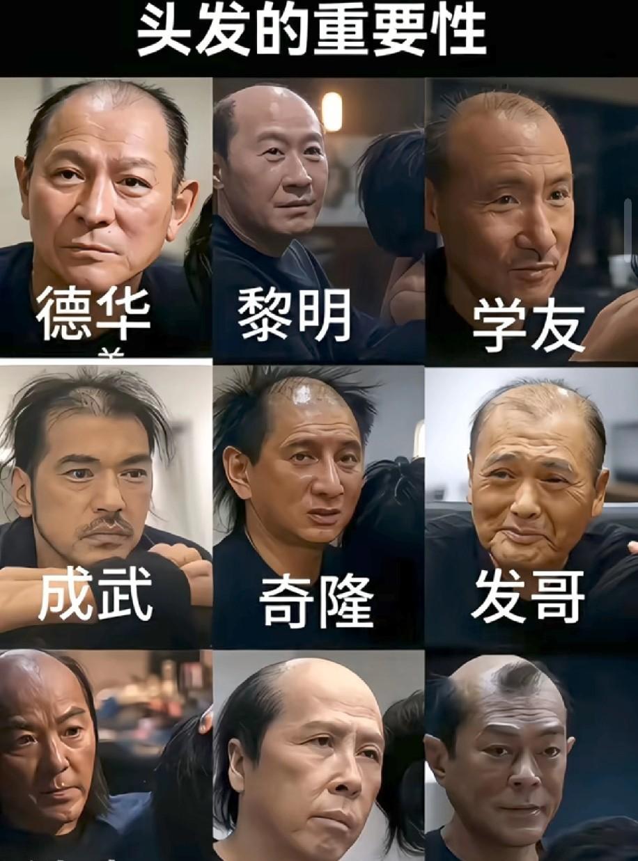 哈哈哈！
笑不活了。
难怪有人说郑少秋顶了一辈子假发，
据说他是秃顶。
为了维持