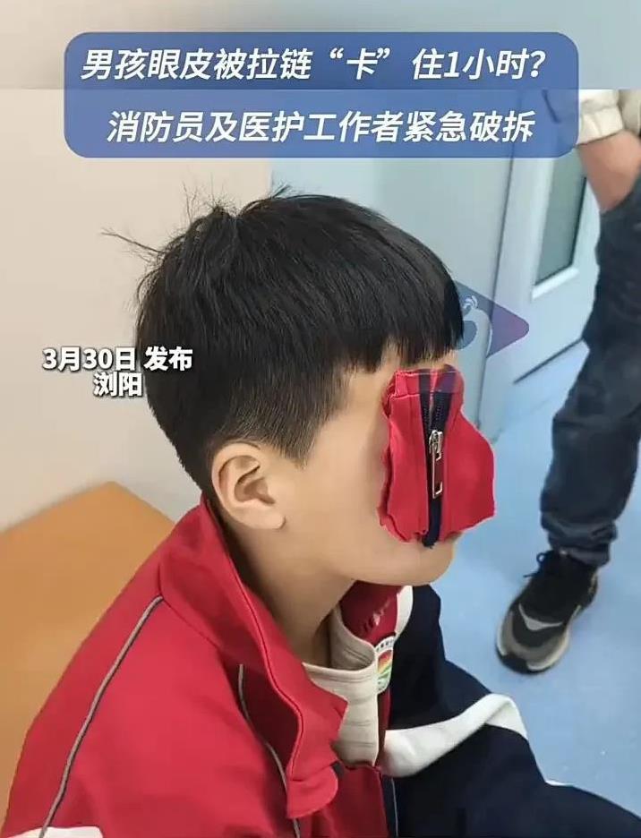 熊孩子再出神操作！3月30日，湖南浏阳一个10岁男孩眼皮不慎被衣服拉链卡住，一动