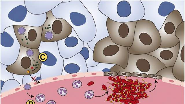 病毒也能治癌？溶瘤病毒疗法已有产品上市，为难治性肿瘤患者带来希望