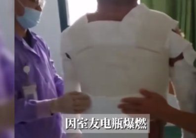 “太缺德了！”8月1日，湖北武汉，一大学生在睡觉时被室友的电动车电池烧伤，总治疗