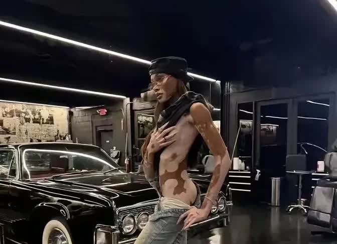 当年迈克尔杰克逊如果这样子变白也不会去世那么早吧！