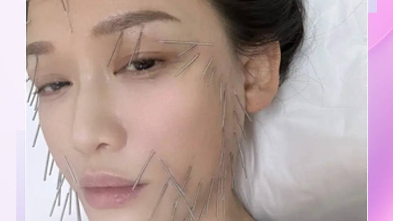 陈乔恩为美容满脸扎针, 宋慧乔钟爱鸟粪面膜, 她们为美也太拼命了！