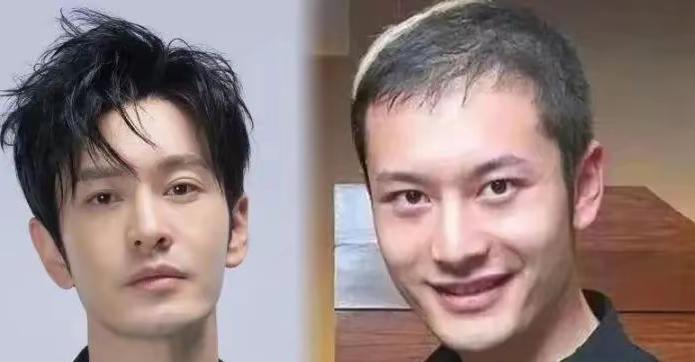看了黄晓明的图片
我默默做了一个决定
不是要戴假发，也不是要去医美，而是要去植发