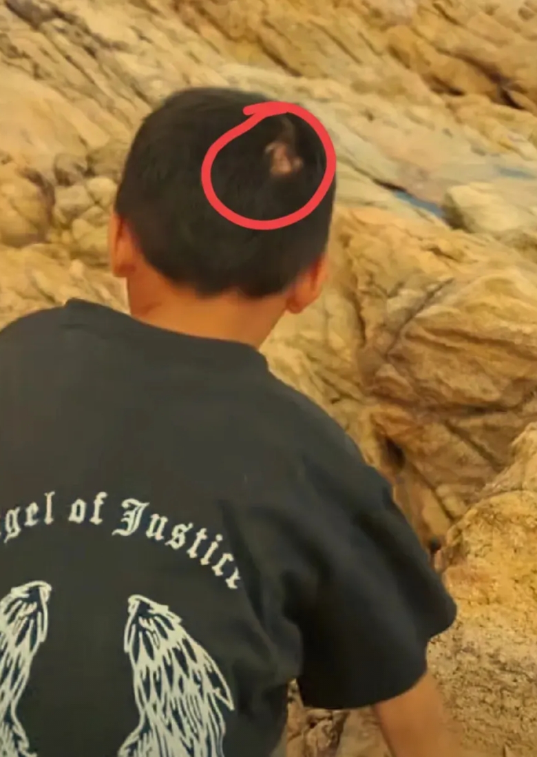 关于赤岭亮哥，又被人挖出了六个不为人知的细节。
1.你发现没有？他的后脑勺上有一