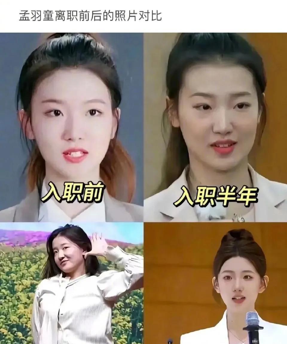 看到孟羽童我才知道，离职才是打工人最好的医美