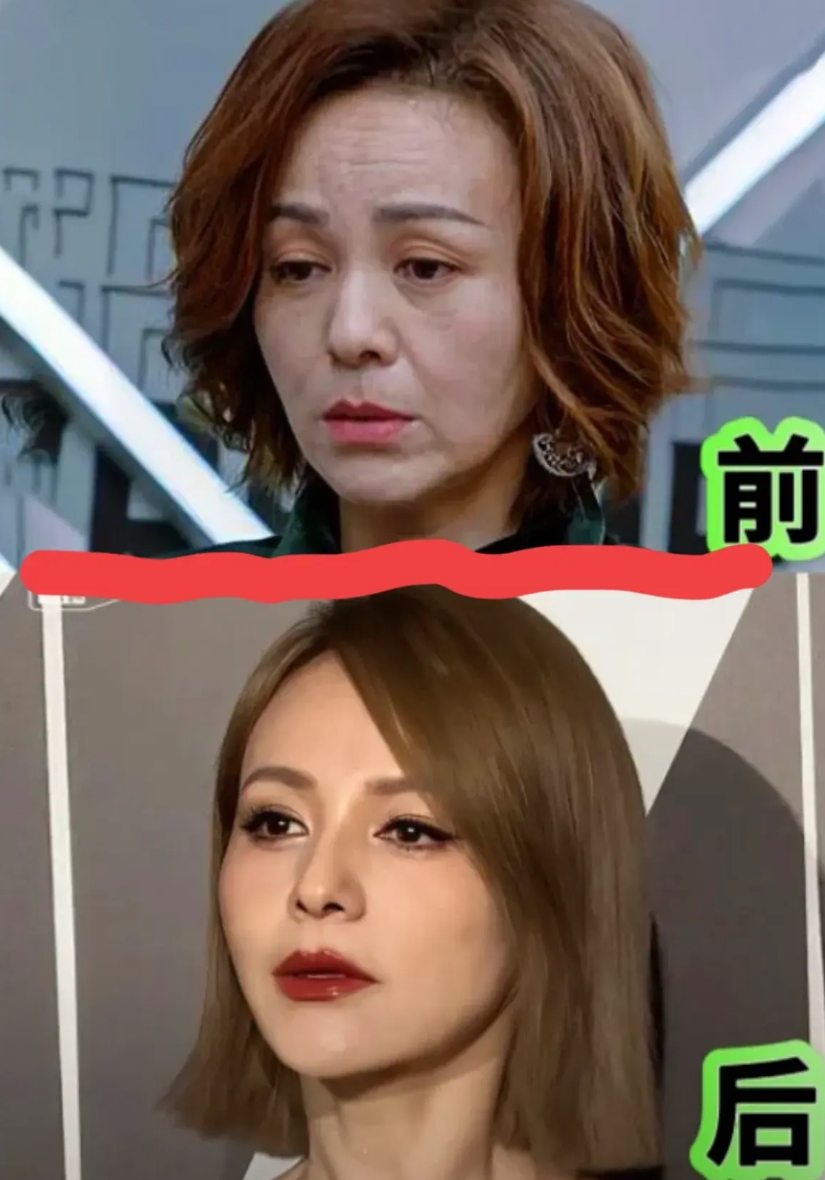 雪姨，能不能把保养秘诀给我？

脸能从干瘪养成饱满，法令纹还可养没有。

眼皮下