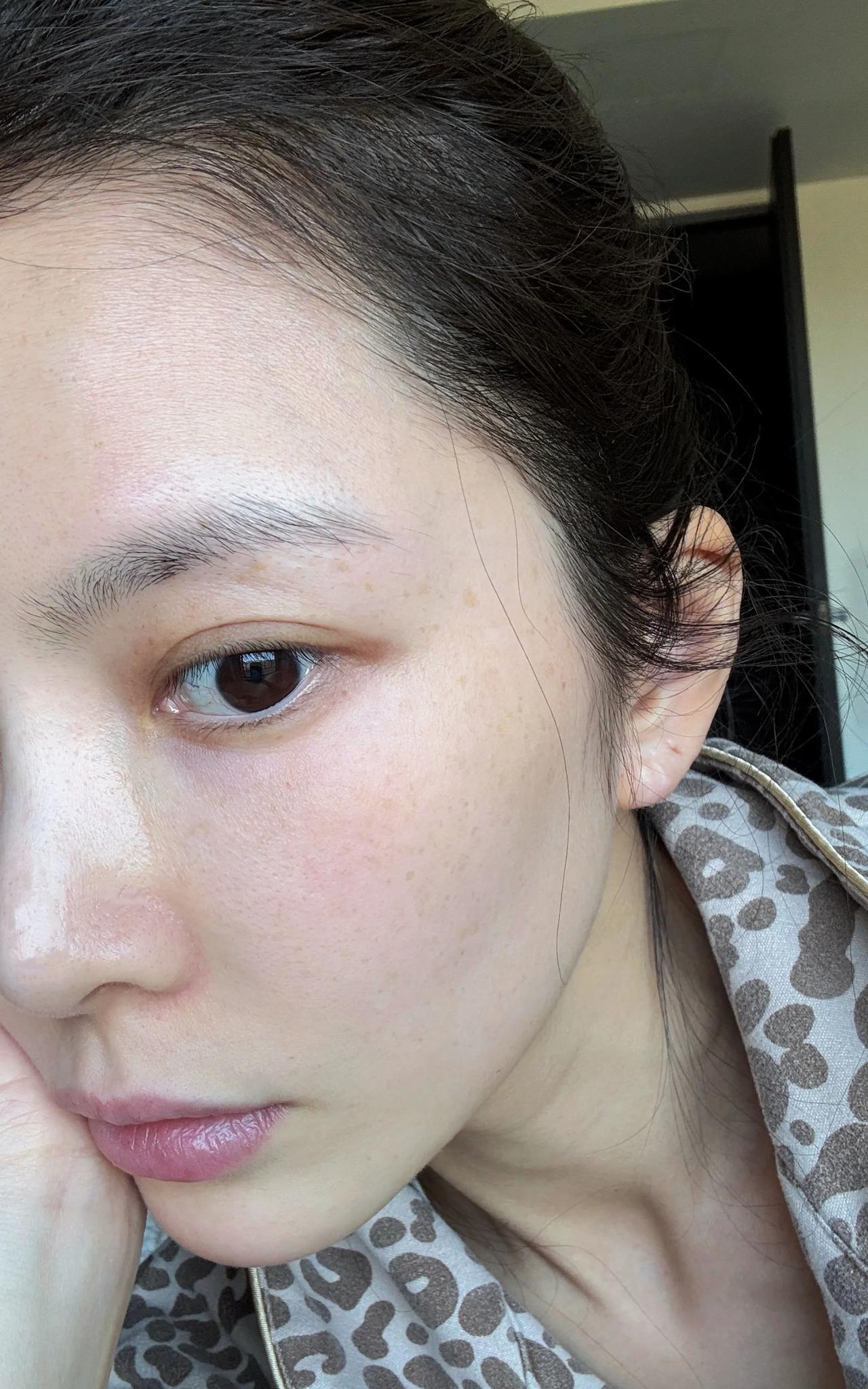 杜淳老婆王灿晒高清无美颜自拍，展示自己的斑点、毛孔还有黑眼圈，告诉大家请允许自己