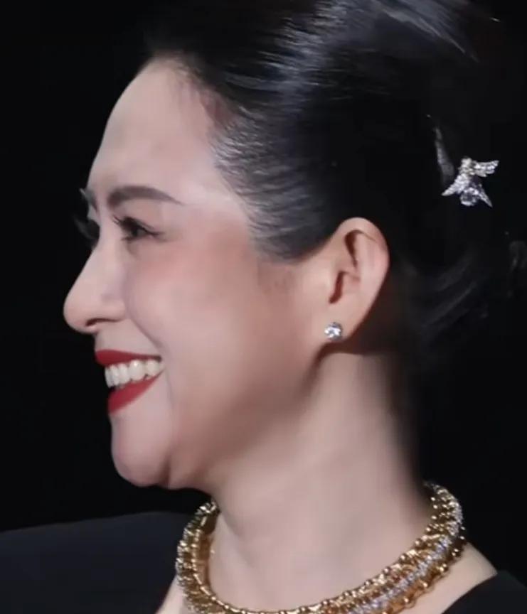 章子怡面部填充后猛一看像倪萍
章子怡的瘦脸一夜之间肿成皮球，猛一看像倪萍。为啥面