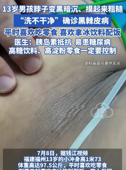 “幸亏发现早！”福建，13岁男孩长到1米73，就在家人们以为他能长大1米9的时候