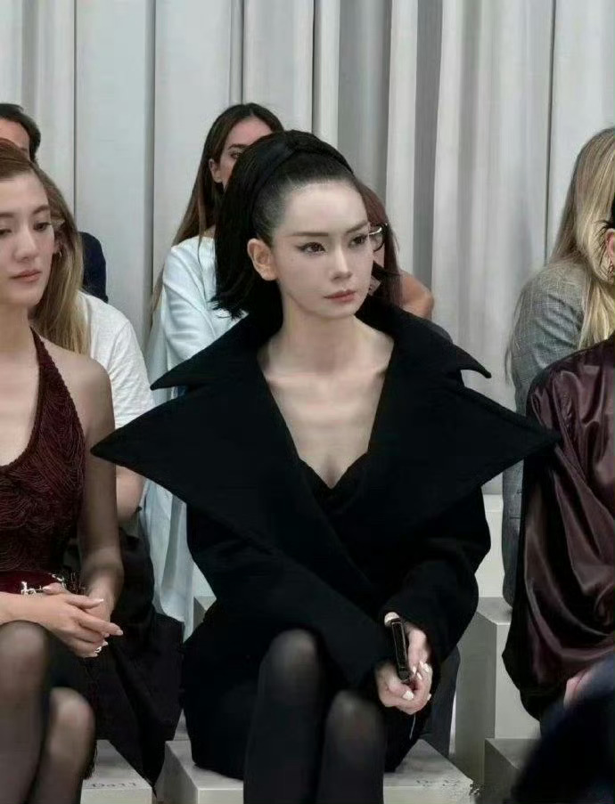 戚薇的头皮看着就疼，她为了美是真能忍…… ​​​