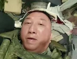 战地记者宇光在战场采访受伤。
俄乌战争一直看卢记者的前线报道，从他的报道中看到了