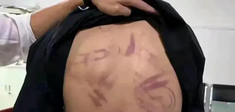 保安动用私刑殴打两个小青年，通告也来了，有5名保安拘留，有1名保安刑拘！
最近有