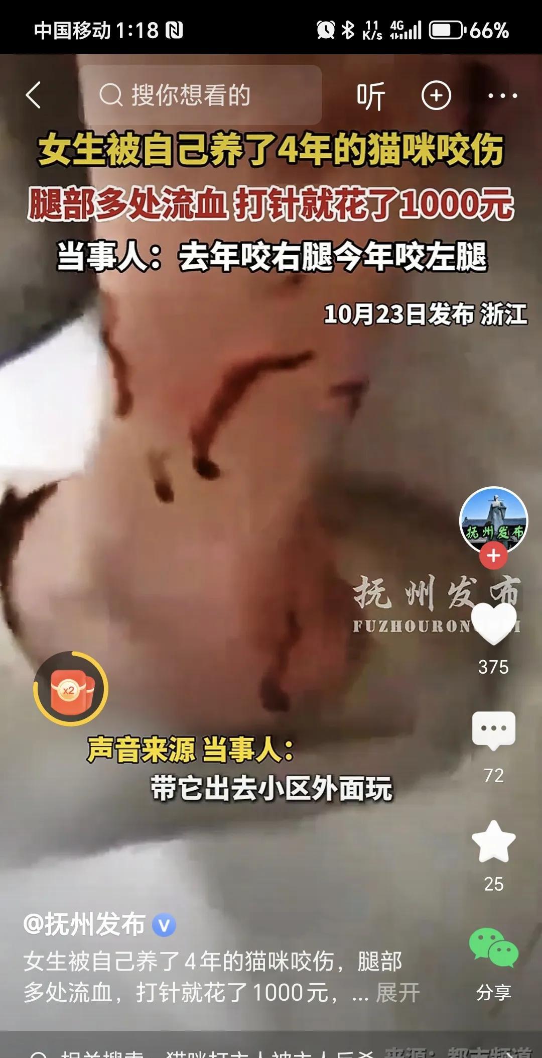女子被猫咬伤，打针花了一千多。
消息来自抚州发布官方帐号的视频。
这就是爱心人士