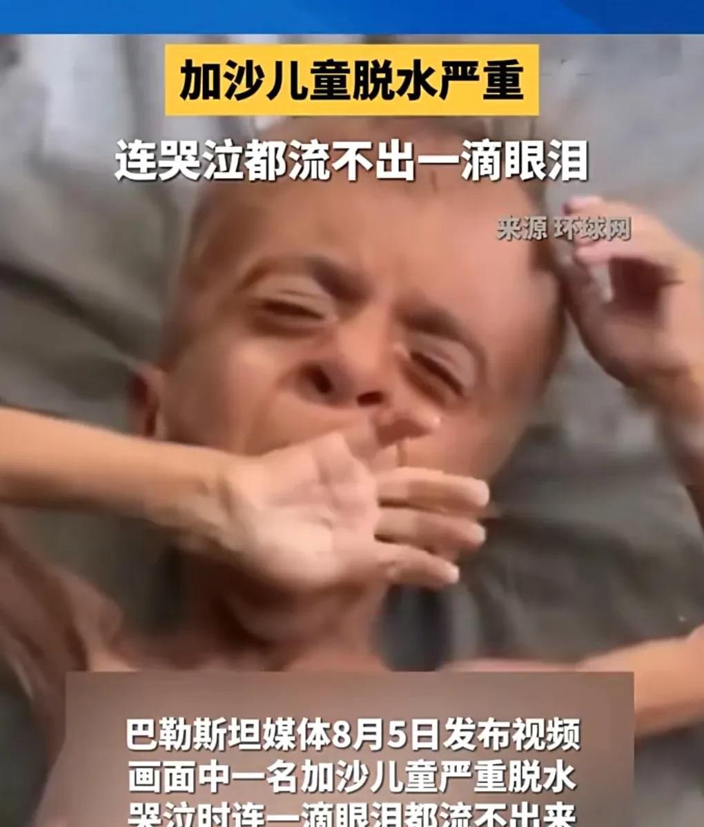 加沙儿童实在是太惨。
8月5日，据媒体报道。
加沙儿童严重脱水，哭时没有一滴眼泪