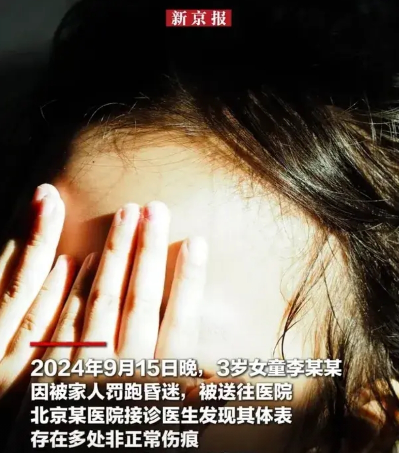 北京，女子和男友，长期以立规矩为由，虐待3岁女儿，他们虐待完孩子，还让她跑步，终
