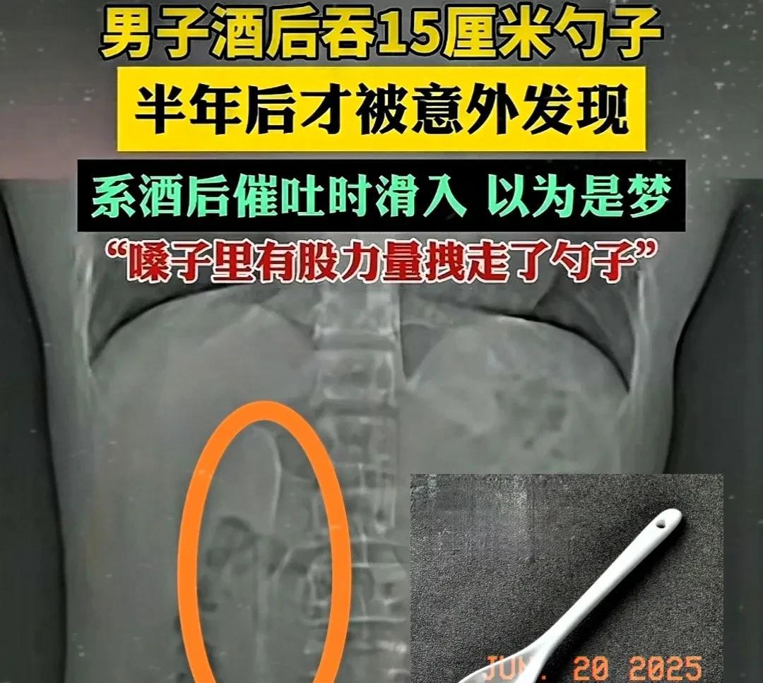 近日，一名男子因吃外卖时吃出异物，心里担忧，便前往医院进行检查。医生在仔细查找异