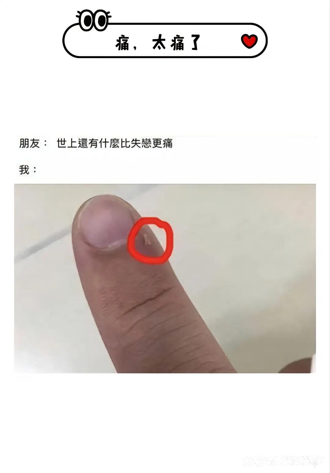 我承认这是最疼之一???