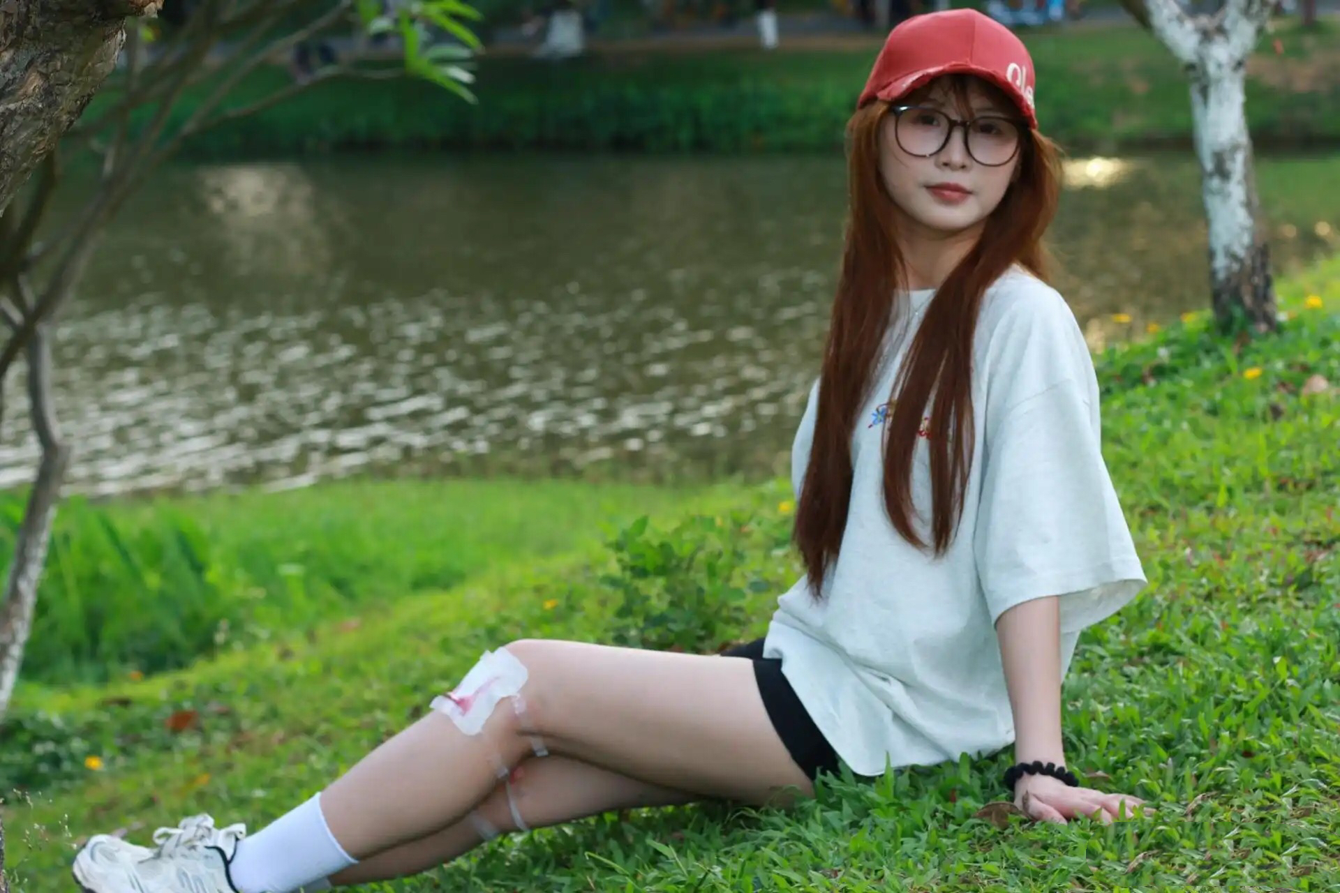 这膝盖是怎么回事？