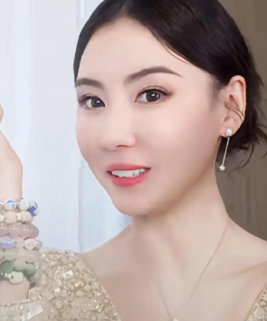 张柏芝的脸变化好大呀，都快认不出来了，难道也医美了？