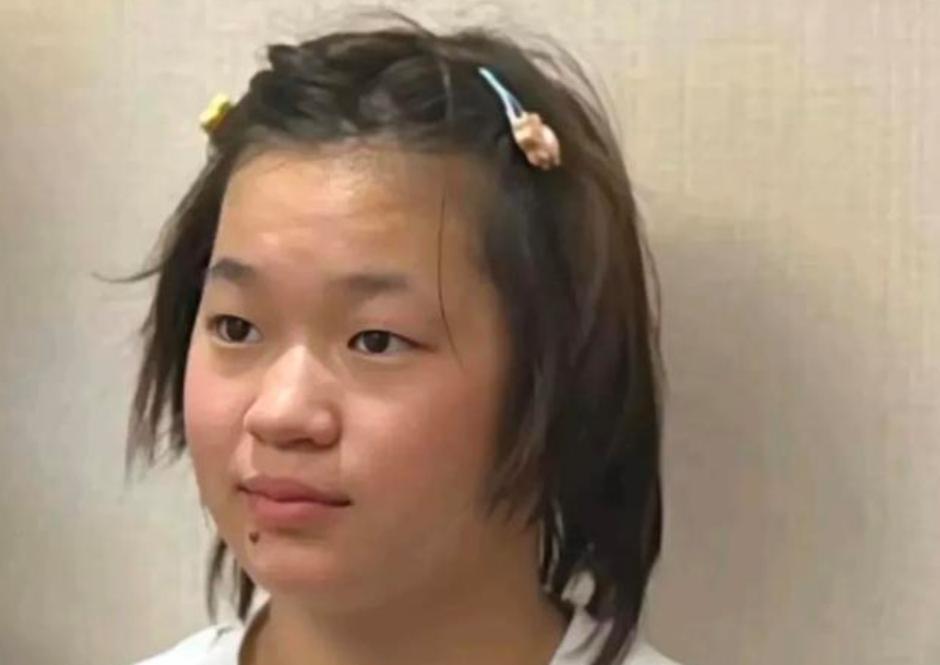 全红婵居然长这样了，奥运三金得主大变样，身材发福明显。
正在养伤的她从近照看，肉