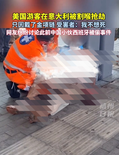 戴金项链米兰被割喉？出门戴金小心！











出门戴金链子，竟然在米