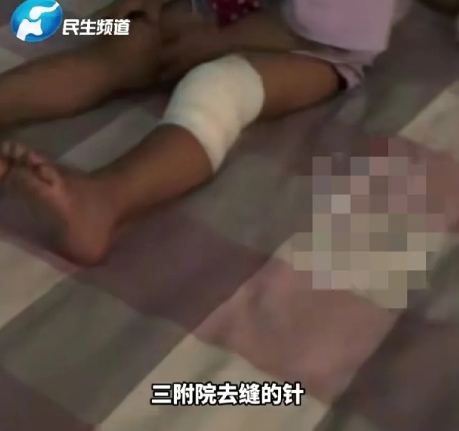 小区为绿化带美观，用几毫米厚钢板做围挡，两岁女童不慎摔倒腿上磕破口子缝三针！6月