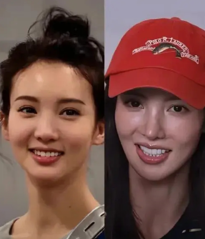 金晨鼻子医美前后对比照片，比较之下大家看出了有什么不一样吗？是更喜欢之前呢还是以