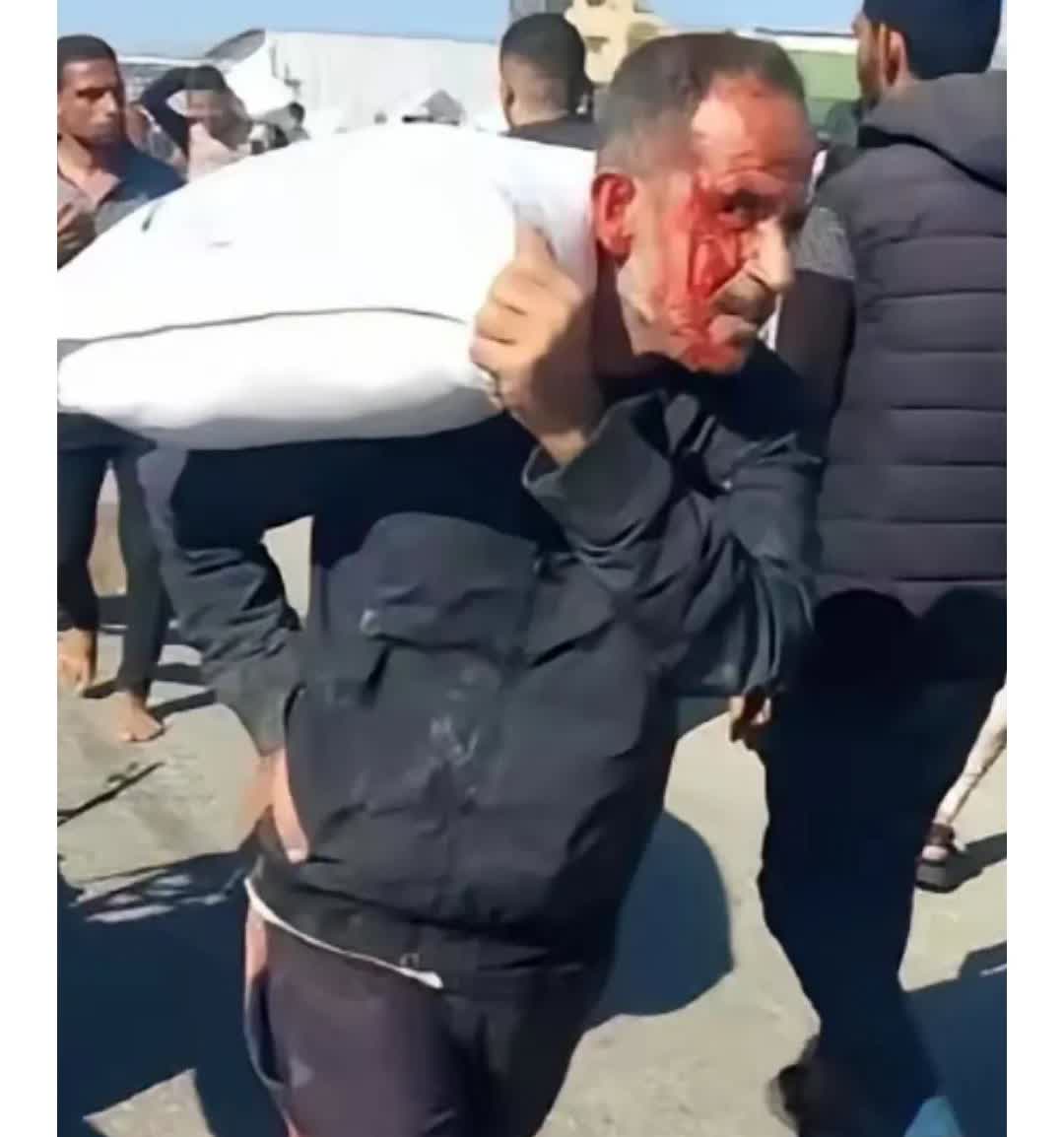 他是加沙人扛的是中国🇨🇳的面粉，为了全家人能活命。然而他脸上血迹伤口是以色列