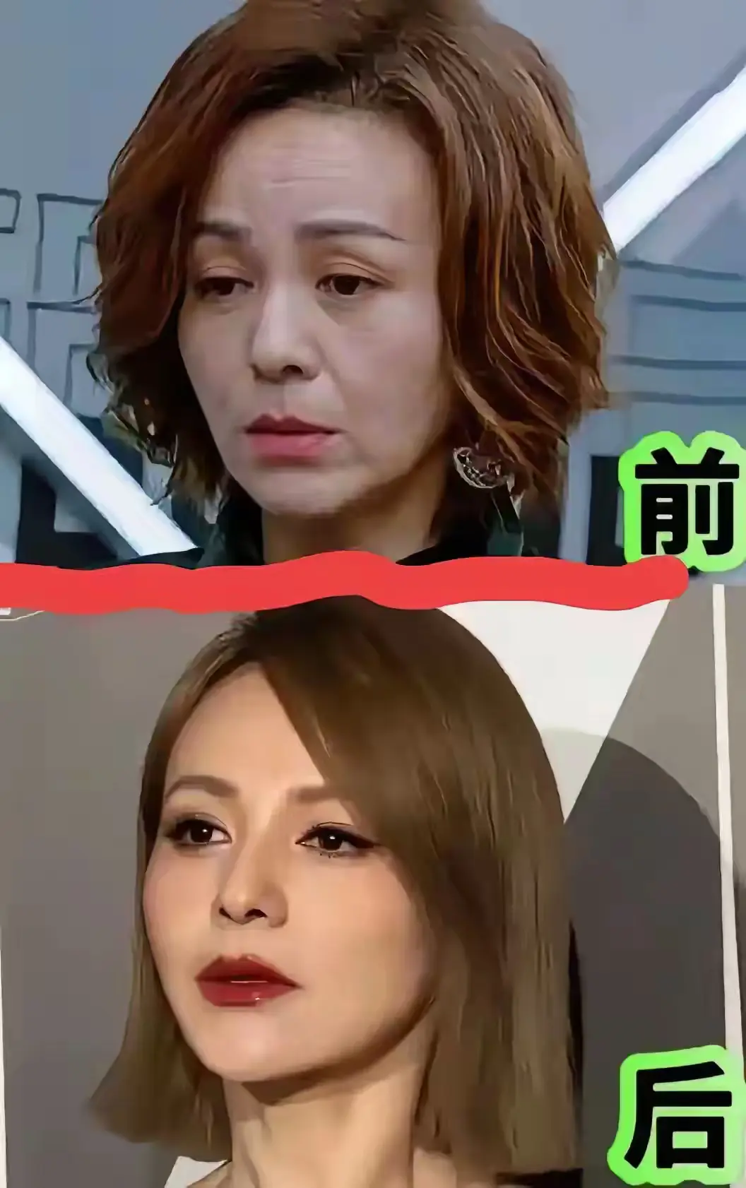女人有钱就一定要整容！