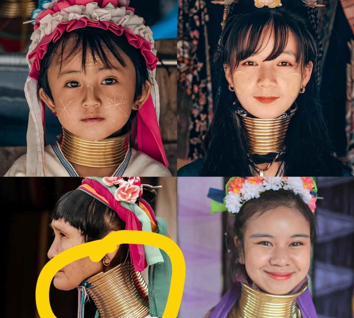 “脖子越长越美”的长颈族
万万没想到以长为美的背后，
竟然隐藏着这个真相！是
难