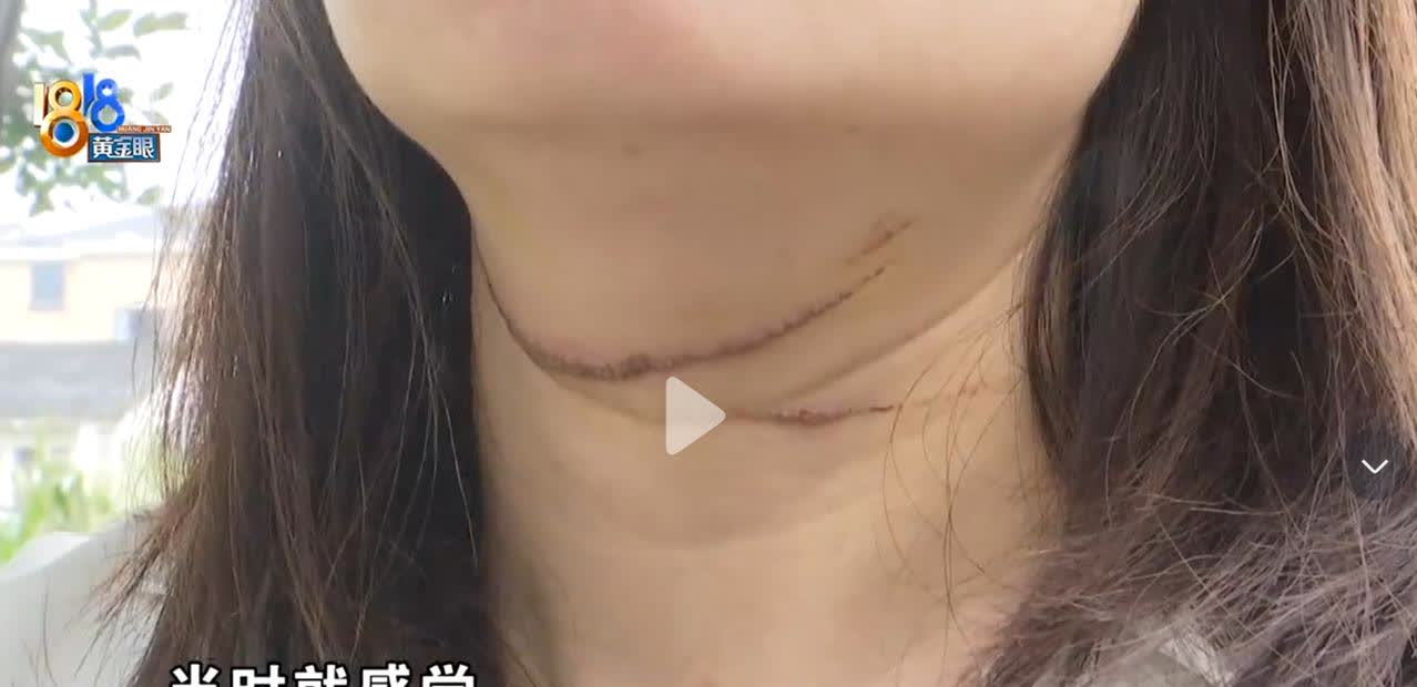 女子外出买菜惨遭风筝线割喉，真的是太可怕了，这是多么危险的一件事情。事发浙江嘉兴