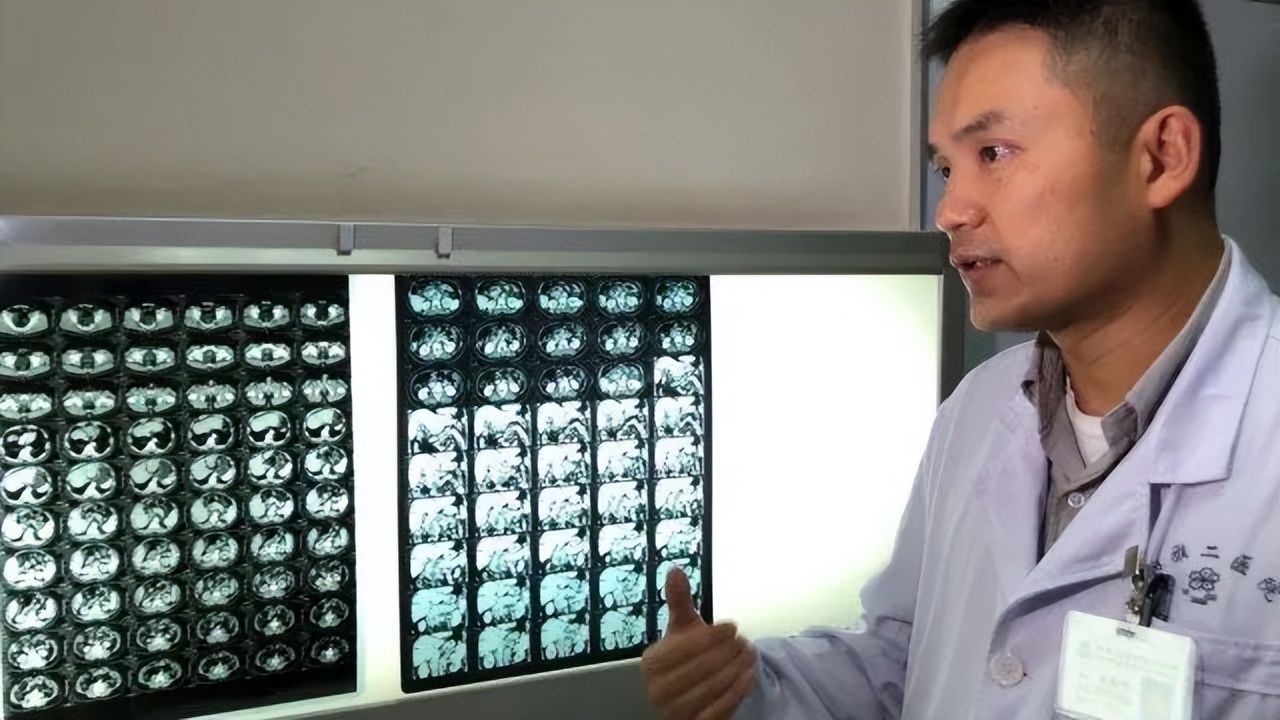 屠夫医生刘翔峰，逼迫病人天价化疗，表面救死扶伤，背地摘人器官