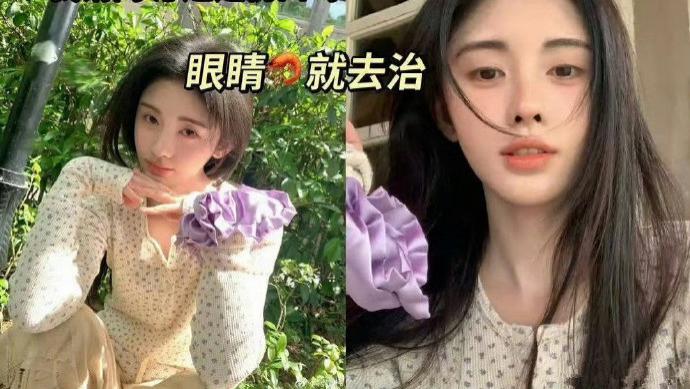 鞠婧祎额头受伤，创可贴下竟藏两大版本？