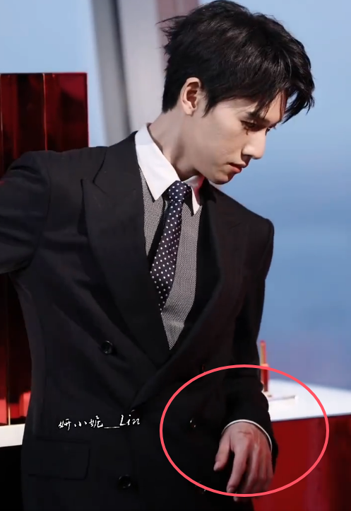 李昀锐手上有伤，都是拍戏敬业的证明。小林出席活动，热搜上了好几个，谁看到这种级别