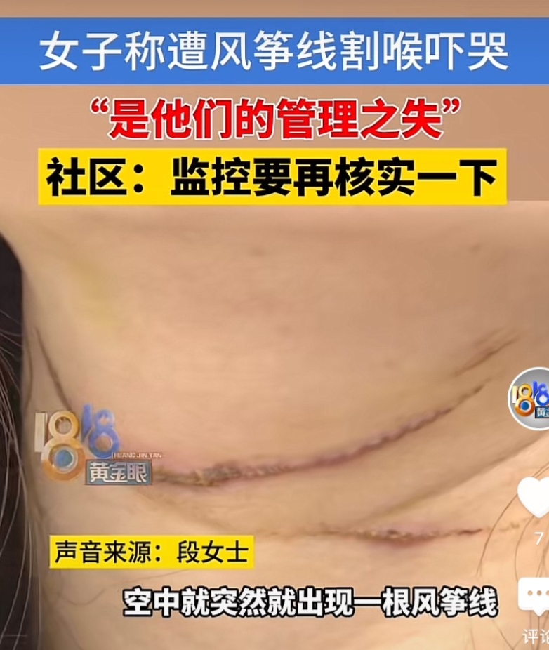 浙江嘉兴，女子和丈夫骑电动车去买菜，在公园附近的一条路上被风筝线割喉，感到喉咙火