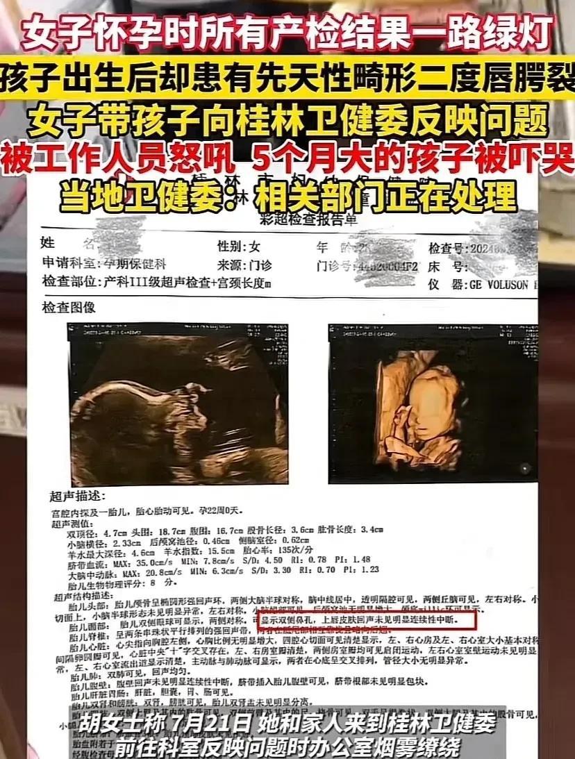 女子产检时一切正常，可孩子出生后却患有先天性畸形2度唇裂。女子抱着年幼的孩子到当
