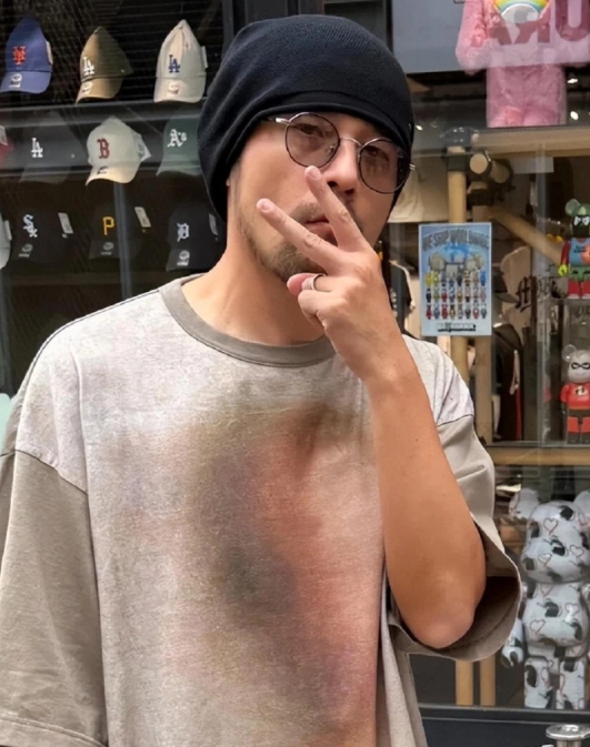 周董好像很早就被确诊患有强直性脊柱炎。

这是一种主要影响脊柱关节和韧带的慢性炎