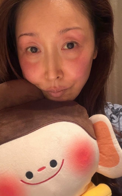 歌手孙悦在山西大同录春晚节目，脸被活生生冻出红晕，不知这种算工伤么